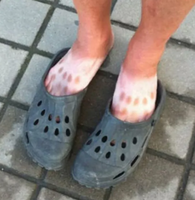 crocs und sonne